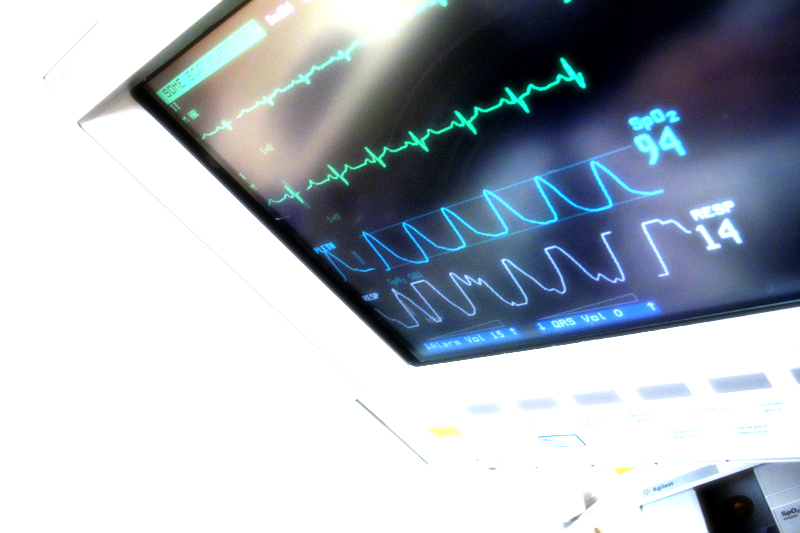 A heart monitor screen.